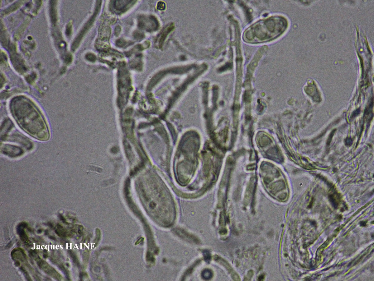Lecanora praepostera auct. non Nyl.